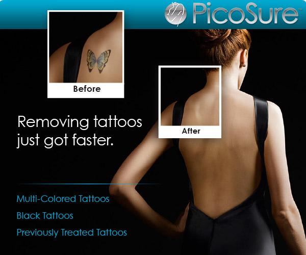 Methods of tattoo removal